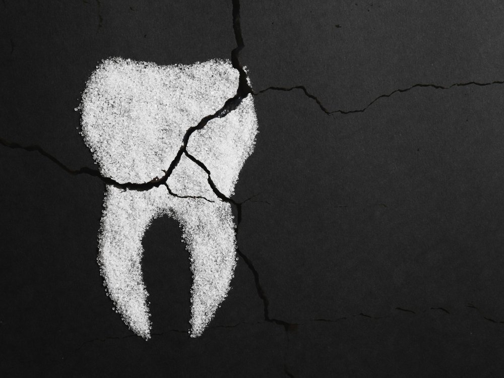 Sugar,Harms,The,Tooth,Enamel.,Image,Of,A,Cracked,Sugar
