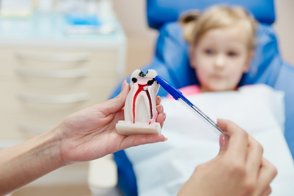 Demonstration,Different,Stages,Caries,On,Tooth,Model,For,Little,Patient