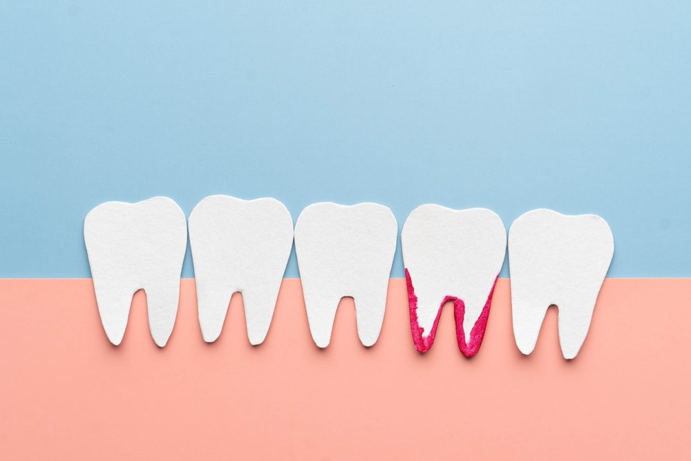 White,Teeth,Bleeding,Cartoon,Made,From,Paper.,Bleeding,Gums,Are